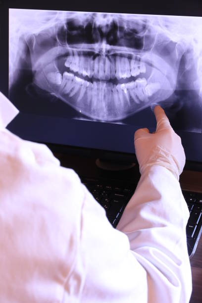 Best Emergency Dentist for Knocked-Out Tooth in Plain City, UT